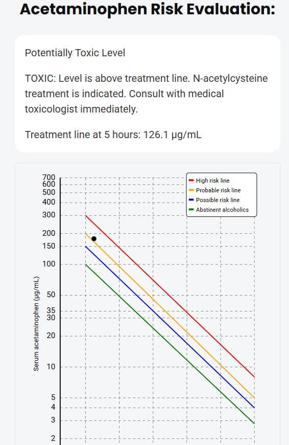 RumackCalc acetaminophen toxicity risk evaluation showing serum acetaminophen level plotted against the Rumack–Matthew nomogram with treatment lines for high risk, probable risk, possible risk, and abstinent alcoholics. The result indicates a potentially toxic level above the treatment threshold, requiring N-acetylcysteine (NAC) therapy. RumackCalc is a MedicalToxic.com tool for rapid acetaminophen overdose assessment and guideline-based treatment decisions