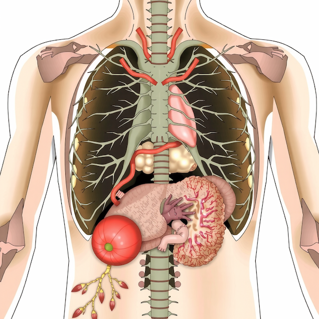 The association between enema and nervous system injury in Diquat poisoning.